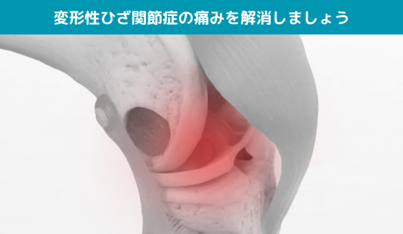 変形性ひざ関節症の痛みを解消しましょう